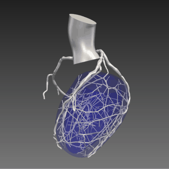 1754400662835068.gif Coronaryvessel.gif